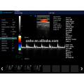 China Máquina do doppler da cor do eco do varredor do ultra-som do trole de Cardiac / OB / GYN